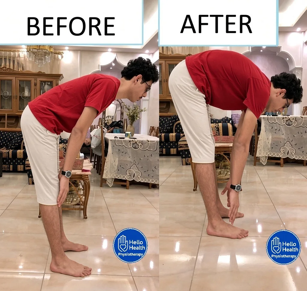 Patient physiotherapy before and after result